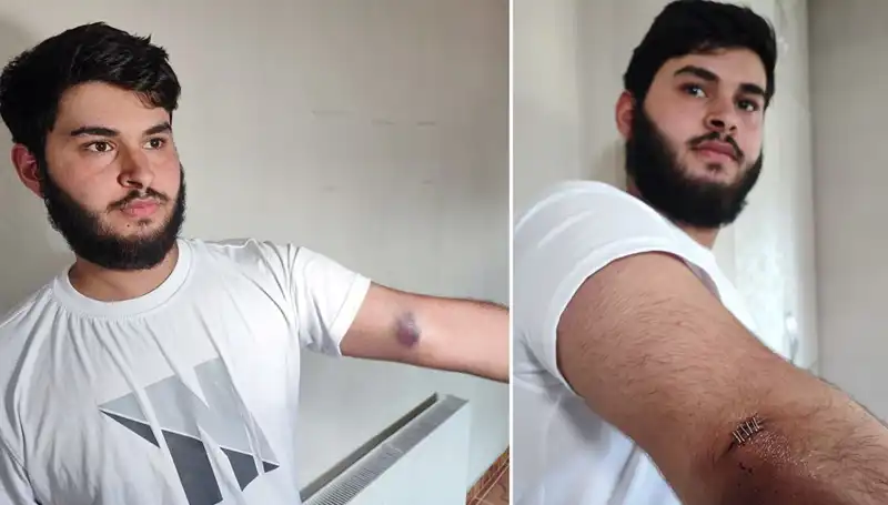 Bahçeye Kaçan Top, Mahallede Büyük Heyecan Yarattı!